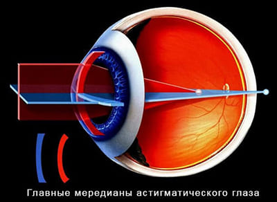 Главные меридианы астигматического глаза